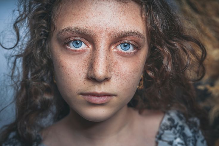 Medicamento para autismo pelo SUS, como solicitar?
