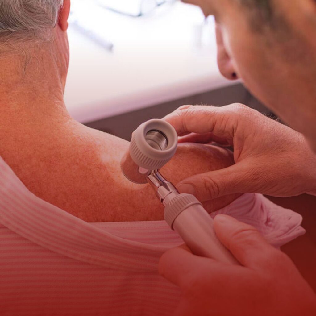 Advogado Especialista em Saúde: Direito a Tratamento para Linfedema Pós-Retirada de Linfonodos