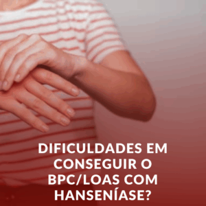 Dificuldades em conseguir o BPC/LOAS com Hanseníase? Veja o que fazer!