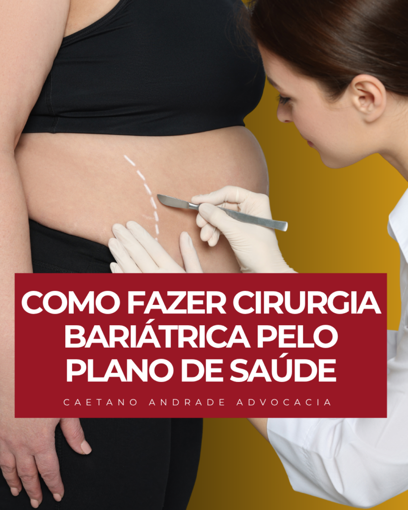 Plano de Saúde Deve Cobrir Cirurgia Bariátrica? Saiba Como Garantir Seu Direito na Justiça